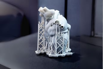 stampa 3D in medicina