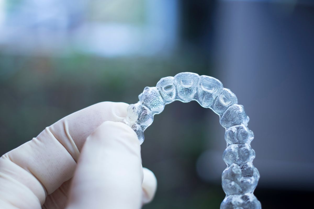 stampa 3d in odontoiatria