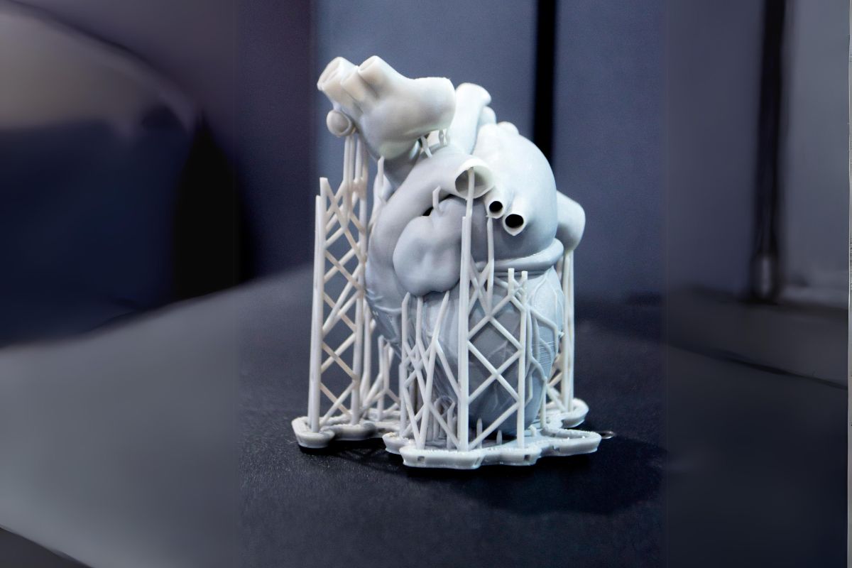 stampa 3D in medicina